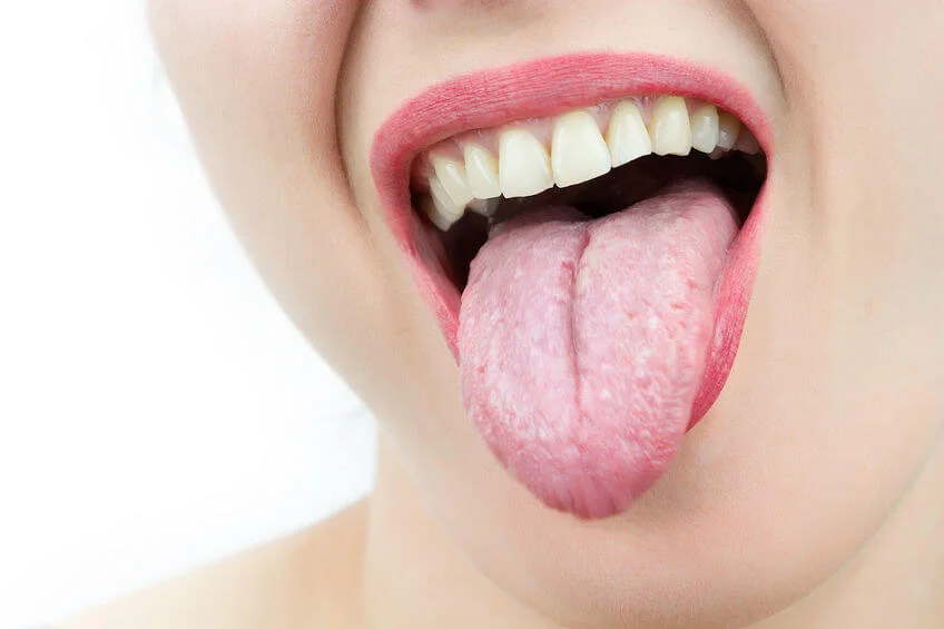  Tongue cleaning – how and why you should do it